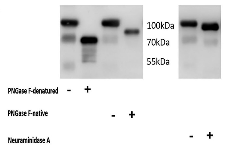 Western blotting of UMOD which was treated with PNGase F and neuraminidase A.jpg